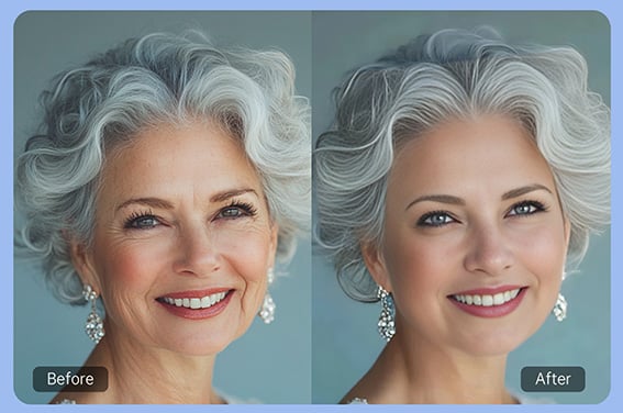 AI Wrinkle Remover AI Wrinkle Remover